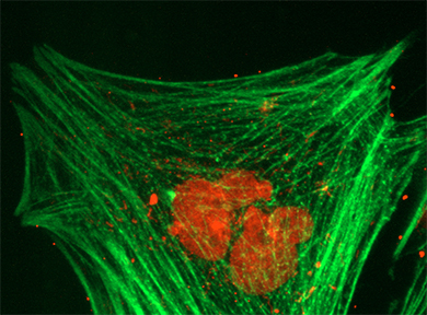 Automated digital microscopy to 100x 